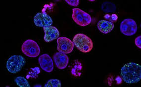 Galecto Publishes GB0139 Phase 2a (IPF) Results in European Respiratory Journal